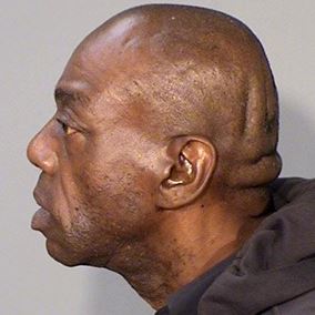 Mugshot Side